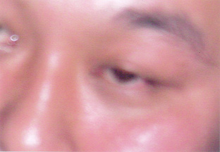 EoEC